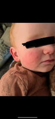 Possible milk allergy or what?
