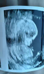 14ish week scan any guesses on whether baby is a boy or girl?