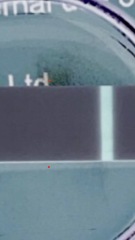 Literally just turned 8dpo… could this be a VVVVFL?