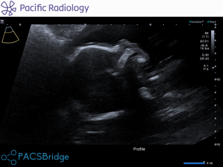 Freaking out need advice
