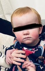 Possible milk allergy or what?