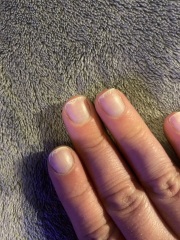 Flaky nails…help!