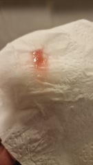 Is this start of mucus plug? Tmi pic