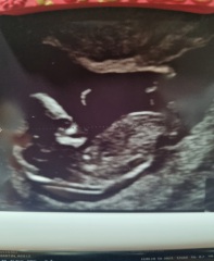 Nub theory - 12 weeks