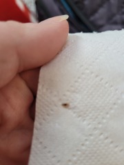 Is this a nit?