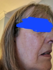 What are these on my face?