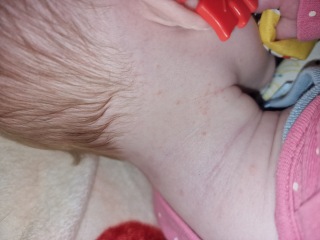 Spots?