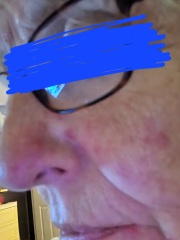 What are these on my face?