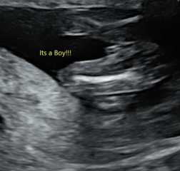 Potty shot at 16 weeks - has yours been wrong?