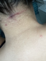 Does this need antibiotics?
