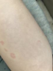 What are these spot things?