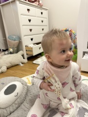 8 month old bump and bruise on head