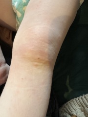 PLEASE HELP DAUGHTER SKIN