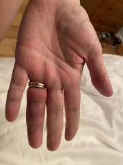 Do I need to get my rings cut off ?