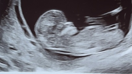 Gender?