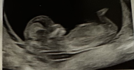 Gender?