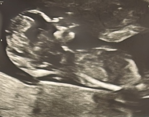 July / August babies let’s see your scans!