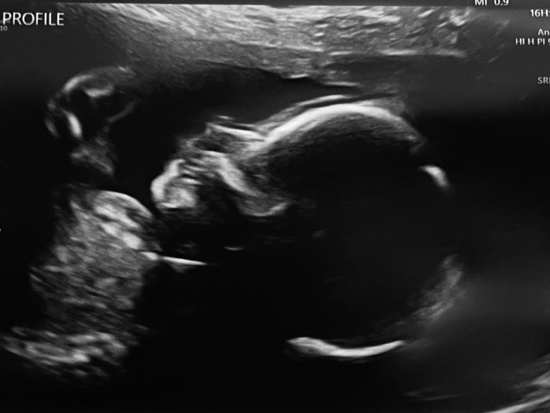 Due June 24 💚 - Part 2
