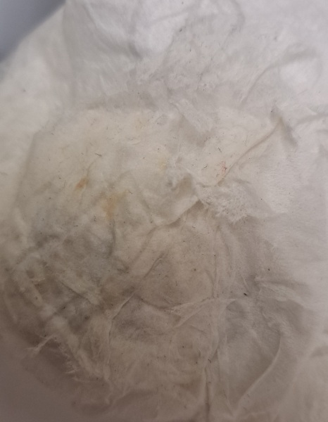 Anyone have any idea what is going on with cervical mucus below?