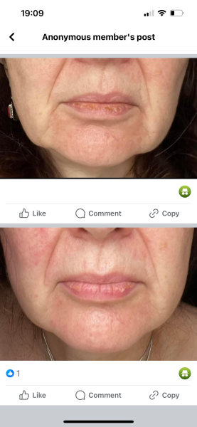 My jowls have actually improved