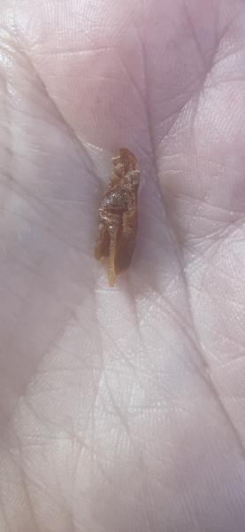 The best thing your body has produced *warning-grim content not suitable for weak-stomached persons*