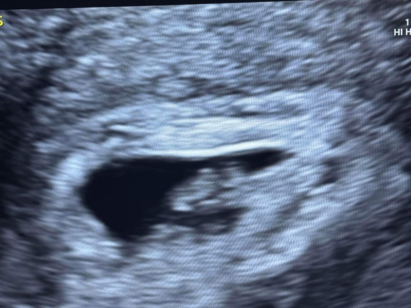 OCTOBER 2024 BABIES!