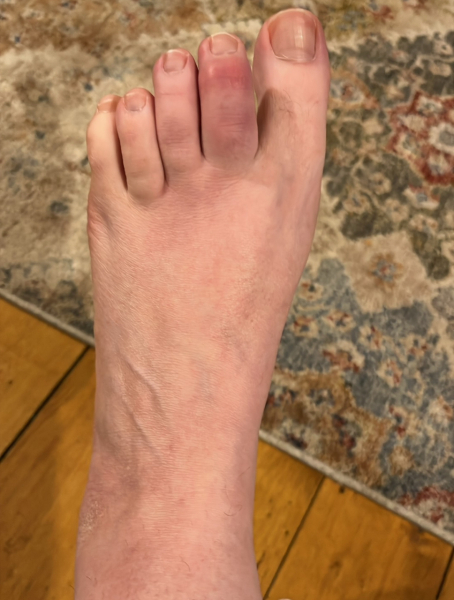 The doctor doesn't know what's wrong with my foot