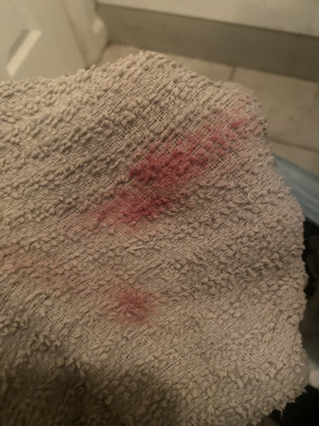 5 weeks pregnant and pink blood (includes picture)