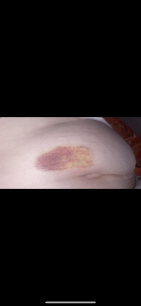 AIBU to be kicking up shit in the doctors?