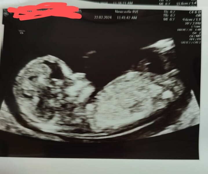 TTC after ectopic/after loss/older age etc ALL WELCOME 🙂