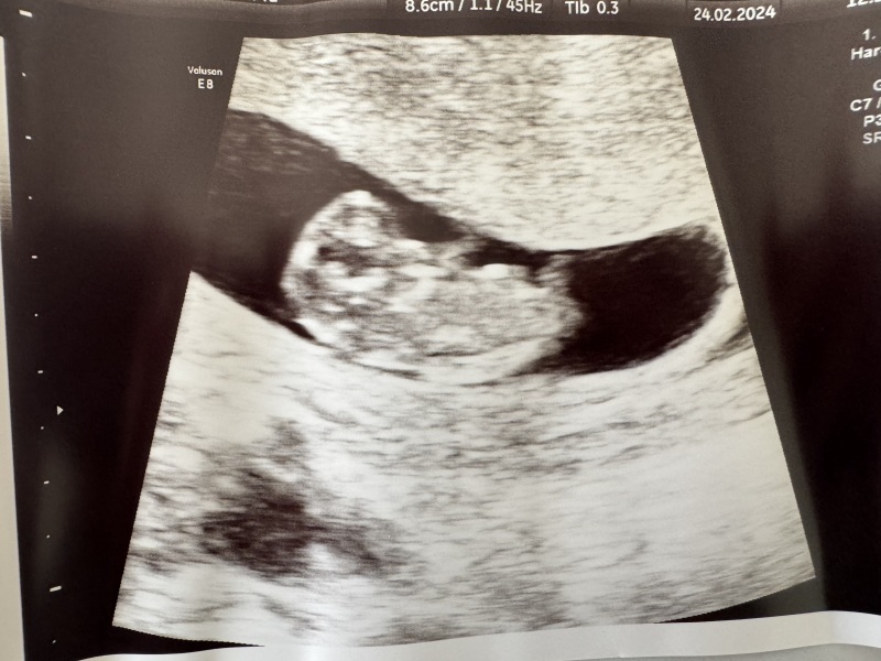 IVF/FET Pregnancies due Oct 2024