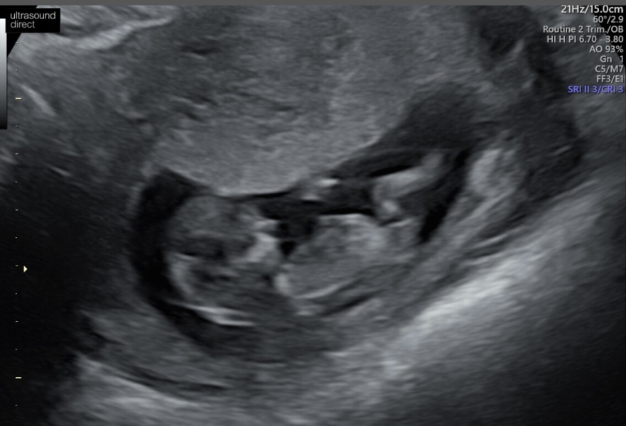 Due September 4.5 🐣♥️🧡💜