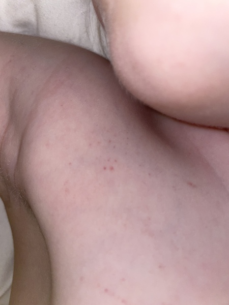 A&E or not with 3 year old