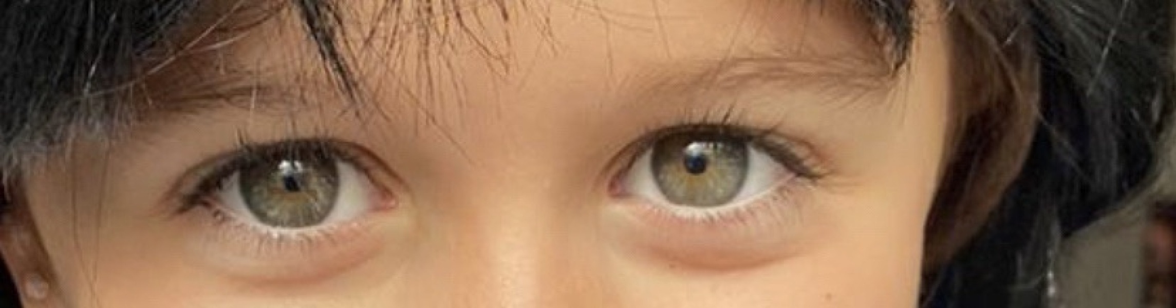 Eye colour