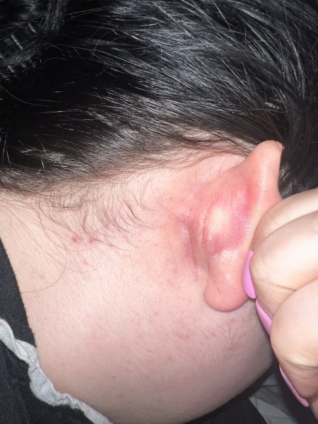 Health anxiety will be the death of me!