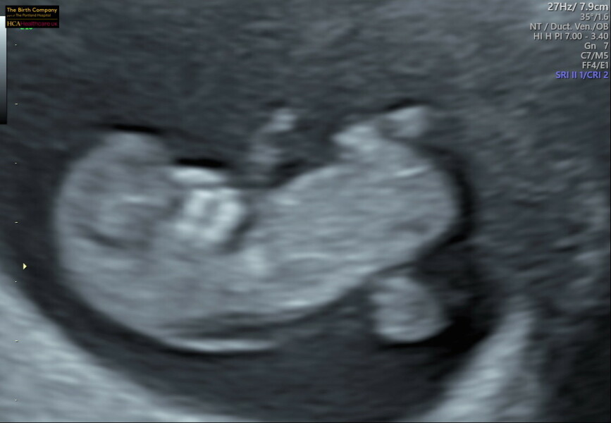 Due September 2024 PART 3 ❤️🩷💛💚💙💜