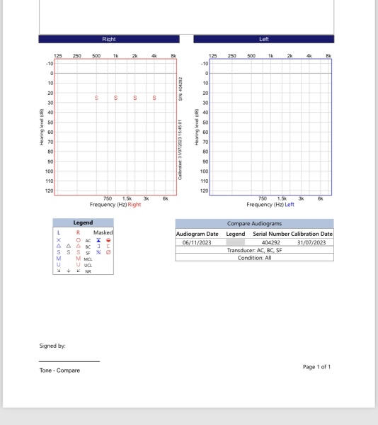 Any audiologists on here?