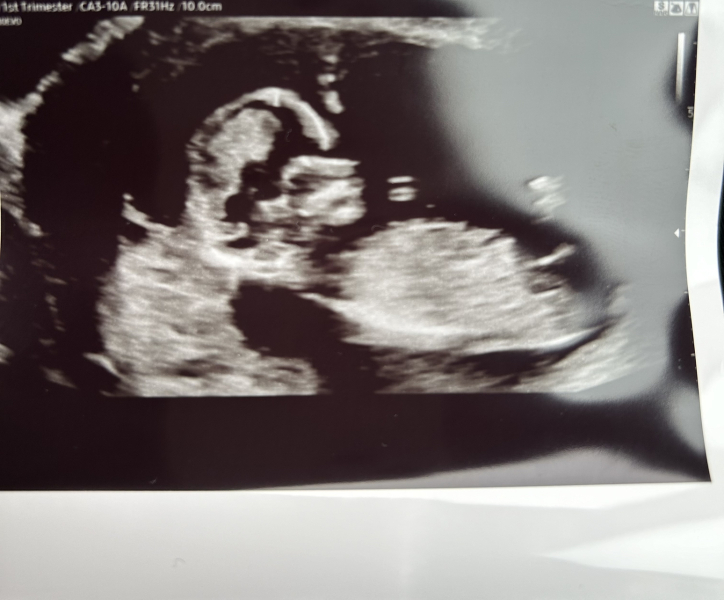 Due September 4.5 🐣♥️🧡💜