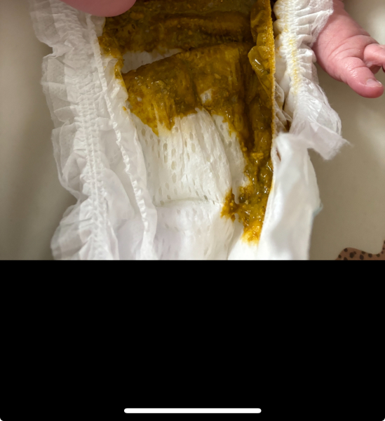 Does this look like cmpa? TMI pics