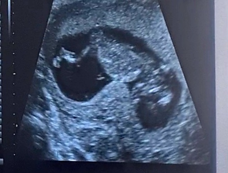 Due September 2024 - Part 4! 🤰🏻💙🩷