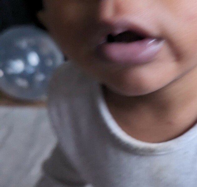 Purple lips and hands?