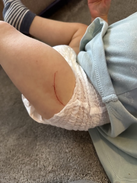 16 month old not moving after vaccinations