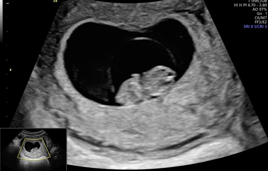 Due September 2024 - Part 4! 🤰🏻💙🩷