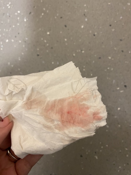 ADVICE PLEASE!! Spotting?? *TW* photos attached