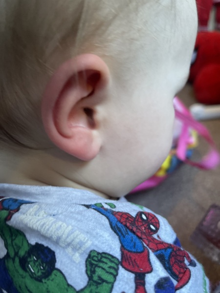 Bright red ear!