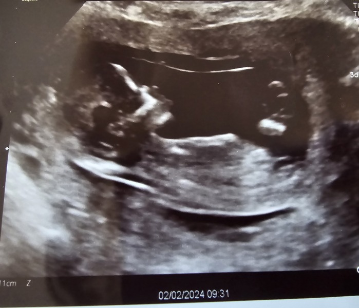 Gender guess?