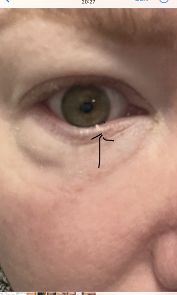 Guess the eye issue?