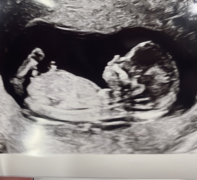 Due September 2024 - Part 4! 🤰🏻💙🩷