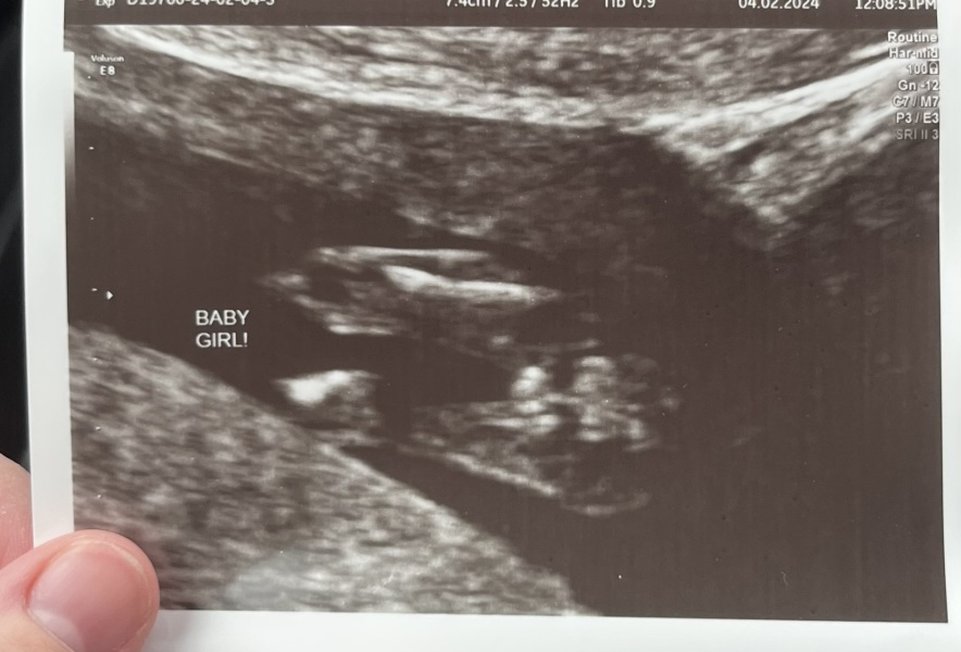 14 week gender scan