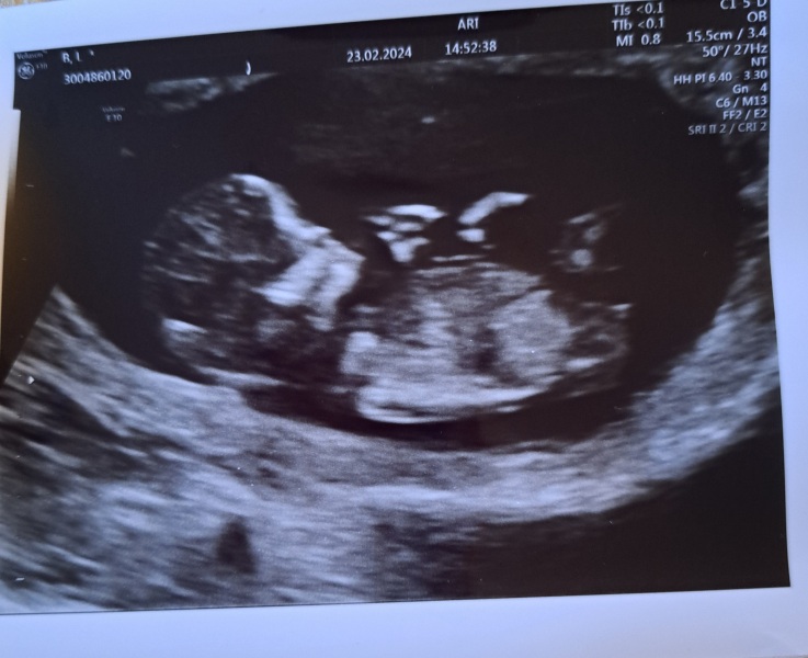 Due September 4.5 🐣♥️🧡💜